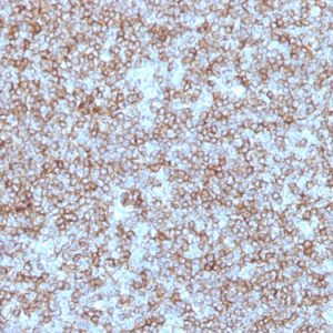 Formalin-fixed, paraffin-embedded human Tonsil stained with HLA-DP/DR Mouse Monoclonal Antibody (Bra-14).