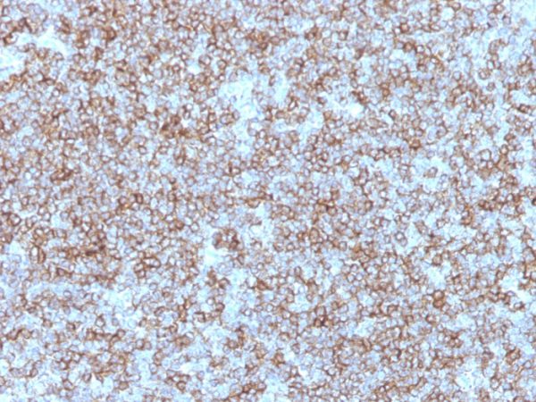Formalin-fixed, paraffin-embedded human Tonsil stained with HLA-DP/DR Mouse Monoclonal Antibody (Bra-14).