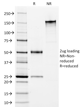SDS-PAGE Analysis of Purified HLA-DP/DR Mouse Monoclonal Antibody (Bra-14).