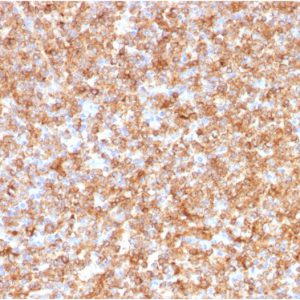 Formalin-fixed, paraffin-embedded human Tonsil stained with HLA- Pan Mouse Monoclonal Antibody (CR3/43).