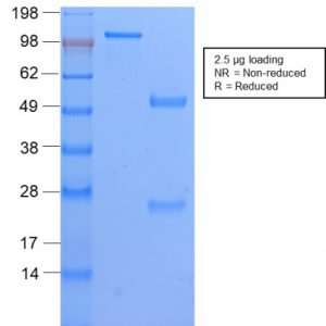 SDS-PAGE Analysis of Purified HLA-DP Rabbit Recombinant Monoclonal Ab (HLA-DPB1/2862R). Confirmation of Purity and Integrity of Antibody.