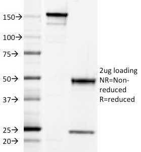 SDS-PAGE Analysis of Purified HLA-DQ Mouse Monoclonal Antibody (SPV-L3). Confirmation of Integrity and Purity of Antibody.