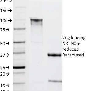 SDS-PAGE Analysis of Purified HLA-DRA Mouse Monoclonal Antibody (IPO-10). Confirmation of Integrity and Purity of Antibody.