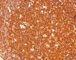 Formalin-fixed, paraffin-embedded human tonsil stained with HLA-DR Mouse Monoclonal Antibody (SPM289).