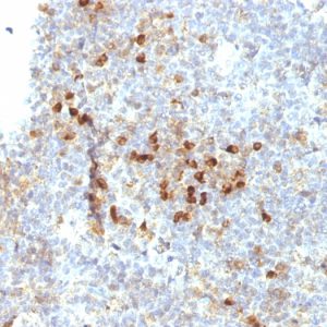 Formalin-fixed, paraffin-embedded human Tonsil stained with HLA-DRA Mouse Monoclonal Antibody (19-26.1).