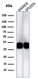 Western Blot Analysis of Ramos cell and human spleen lysate using HLA-DR Mouse Monoclonal Antibody (LN-3).