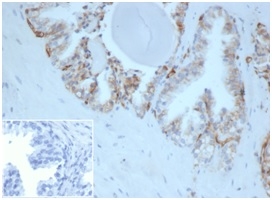 Formalin-fixed, paraffin-embedded human prostate stained with HLA-G Mouse Monoclonal Antibody (HLAG/6686) at 2ug/ml. Inset: PBS instead of primary antibody, secondary negative control.