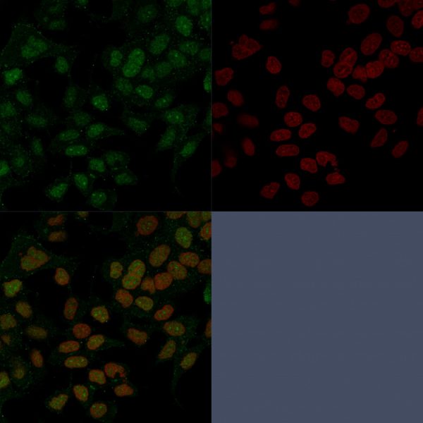 Immunofluorescence  Analysis of PFA-fixed MCF-7  cells labeled with FOXA1 Mouse Monoclonal  Antibody (FOXA1/1241) followed by goat anti- mouse IgG-CF488. Counterstain is RedDot.