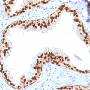 Formalin-fixed, paraffin-embedded human prostate stained with FOXA1 Mouse Monoclonal Antibody (FOXA1/1512).