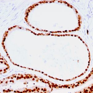 Formalin-fixed, paraffin-embedded human Prostate stained with FOXA1 Mouse Monoclonal Antibody (FOXA1/1516).