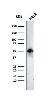 Western Blot Analysis of HeLa cell lysate using FOXA1 Rabbit Recombinant Monoclonal Antibody (FOXA1/2230R).