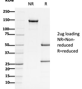 SDS-PAGE Analysis of Purified APC Mouse Monoclonal Antibody (ALi 12-28). Confirmation of Purity and Integrity of Antibody.