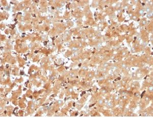 Formalin-fixed, paraffin-embedded human liver stained with Haptoglobin Mouse Monoclonal Antibody (HP/3840) at 2ug/ml.