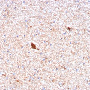 Formalin-fixed, paraffin-embedded human Brain stained with Serum Amyloid P Mouse Monoclonal Antibody (APCS/3240).