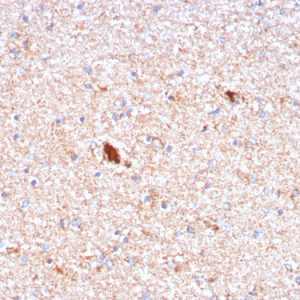 Formalin-fixed, paraffin-embedded human Brain stained with Serum Amyloid P Mouse Monoclonal Antibody (APCS/3240). Serum Amyloid P / APCS Antibody
