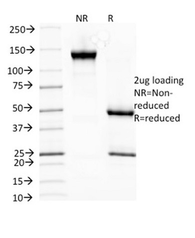 SDS-PAGE Analysis Purified HSP27 Mouse Monoclonal Antibody (SPM252). Confirmation of Integrity and Purity of Antibody.