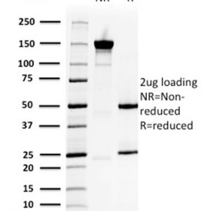 SDS-PAGE Analysis Purified HSP27 Mouse Monoclonal Antibody (CPTC-HSPB1-2). Confirmation of Purity and Integrity of Antibody