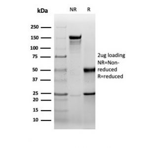 SDS-PAGE Analysis Purified HSP27 Recombinant Mouse Monoclonal Antibody (rHSPB1/6489). Confirmation of Purity and Integrity of Antibody.