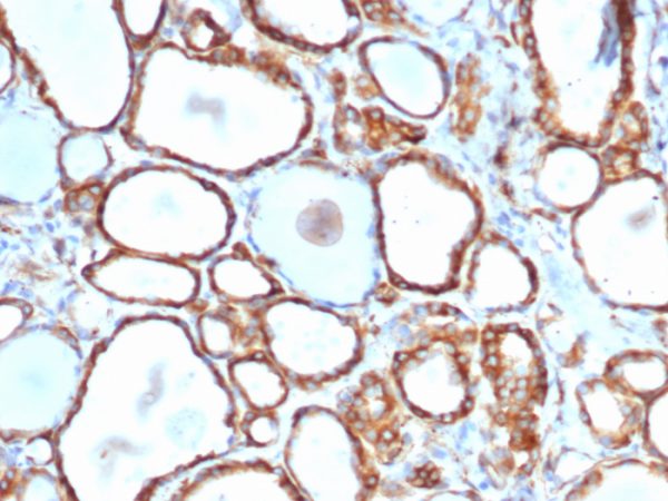 Formalin-fixed, paraffin-embedded human thyroid stained with HSP27 Recombinant Mouse Monoclonal Antibody (rHSPB1/6489).