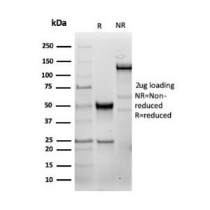 SDS-PAGE Analysis Purified HSP27 Recombinant Rabbit Monoclonal Antibody (HSPB1/6490R). Confirmation of Purity and Integrity of Antibody.