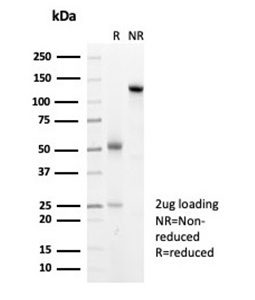 SDS-PAGE Analysis Purified HSP27 Recombinant Rabbit Monoclonal Antibody (HSPB1/7038R). Confirmation of Purity and Integrity of Antibody.
