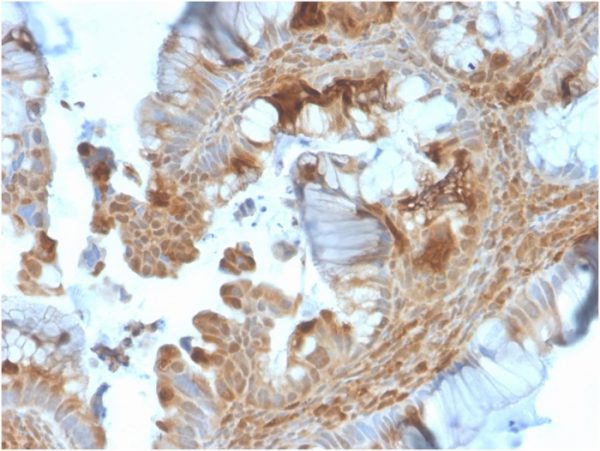 Formalin-fixed, paraffin-embedded human prostate stained with HSP90AB1 Mouse Monoclonal Antibody (HSP90AB1/3953).