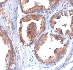 Formalin-fixed, paraffin-embedded human prostate stained with HSP90AB1 Mouse Monoclonal Antibody (HSP90AB1/4970). HIER: Tris/EDTA, pH9.0, 45min. 2 °: HRP-polymer, 30min. DAB, 5min.