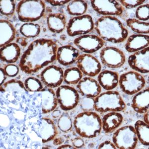 Formalin-fixed, paraffin-embedded human kidney stained with HSP60 Recombinant Mouse Monoclonal Antibody (rHSPD1/6497). Inset: 2 ° Ab only control. Hematoxylin counterstain.