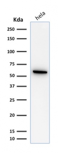 Western Blot Analysis of HeLa cell lysate using HSP60 Mouse Monoclonal Antibody (SPM253)