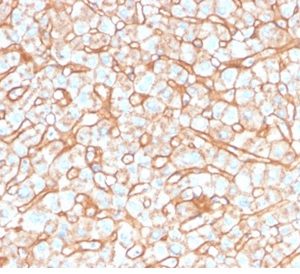 Formalin-fixed, paraffin-embedded human liver stained with Apolipoprotein B Mouse Monoclonal Antibody (APOB/4332).