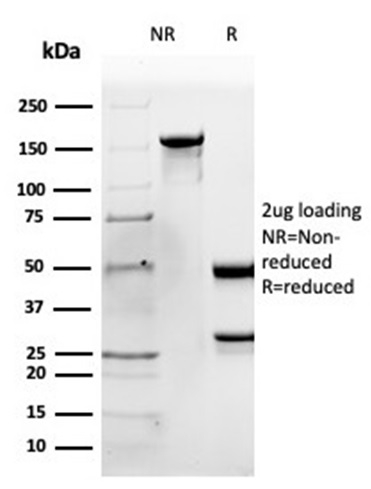 SDS-PAGE Analysis of Purified Apolipoprotein B Mouse Monoclonal Antibody (APOB/4335). Confirmation of Purity and Integrity of Antibody.