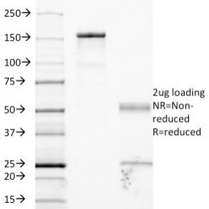 SDS-PAGE Analysis of Purified CD54 Monoclonal Antibody (W-CAM-1). Confirmation of Integrity and Purity of Antibody.