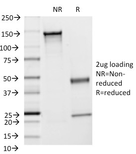 SDS-PAGE Analysis of Purified CD54 Monoclonal Antibody (F4-31C2). Confirmation of Integrity and Purity of Antibody