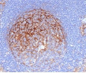 Formalin-fixed, paraffin-embedded human lymph node stained with CD54 / ICAM-1 Mouse Monoclonal Antibody (ICAM1/6319).