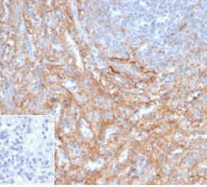 Formalin-fixed, paraffin-embedded human spleen stained with CD54 / ICAM-1 Mouse Monoclonal Antibody (ICAM1/6917). Inset: PBS instead of primary antibody; secondary only negative control.