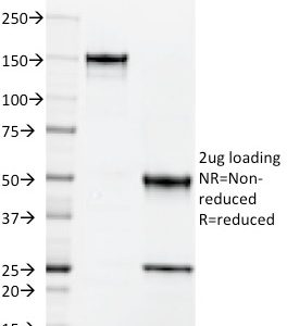 SDS-PAGE Analysis of Purified CD50 Mouse Monoclonal Antibody (101-1D2). Confirmation of Purity and Integrity of Antibody.