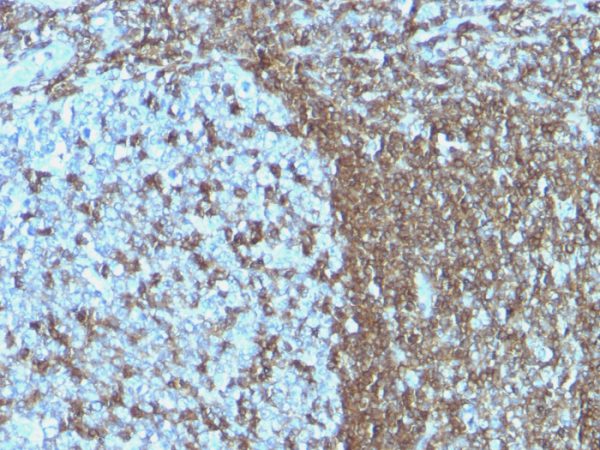Formalin-fixed, paraffin-embedded human Tonsil stained with CD50 Monoclonal Antibody (ICAM3/1019)