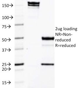 SDS-PAGE Analysis of Purified CD50 Mouse Monoclonal Antibody (CG106). Confirmation of Purity and Integrity of Antibody.