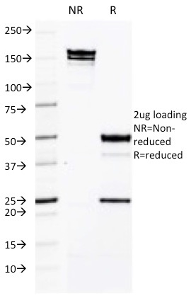 SDS-PAGE Analysis of Purified CD50 Mouse Monoclonal Antibody (CG106). Confirmation of Purity and Integrity of Antibody.