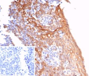 Formalin-fixed, paraffin-embedded human tonsil stained with STING1 Mouse Monoclonal Antibody (STING1/7431). Inset: PBS instead of primary antibody; secondary only negative control.