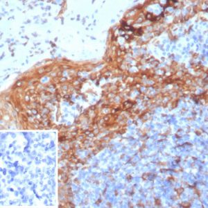 Formalin-fixed, paraffin-embedded human tonsil stained with STING1 Mouse Monoclonal Antibody (STING1/7432). Inset: PBS instead of primary antibody; secondary only negative control.