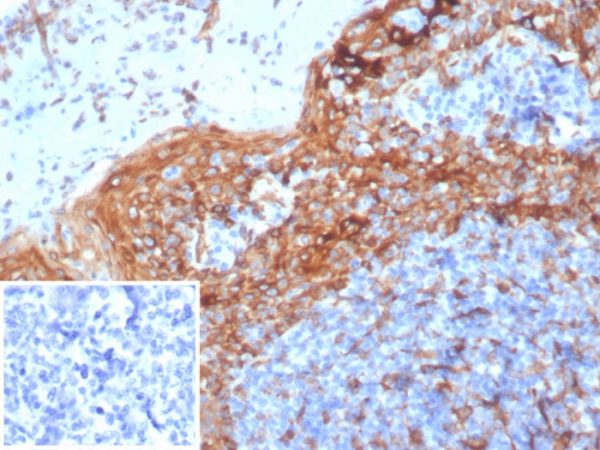 Formalin-fixed, paraffin-embedded human tonsil stained with STING1 Mouse Monoclonal Antibody (STING1/7432). Inset: PBS instead of primary antibody; secondary only negative control.