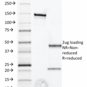 SDS-PAGE Analysis of Purified IFNA1 Mouse Monoclonal Antibody (2-52). Confirmation of Purity and Integrity of Antibody.