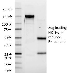 SDS-PAGE Analysis Purified IFNA2 Mouse Monoclonal Antibody (N39). Confirmation of Purity and Integrity of Antibody