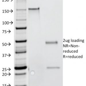 SDS-PAGE Analysis of Purified IFNG Mouse Monoclonal Antibody (G-23). Confirmation of Purity and Integrity of Antibody.