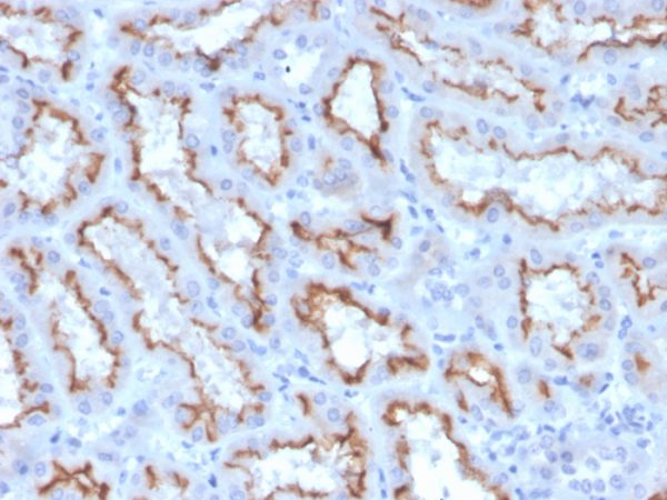 Formalin-fixed, paraffin-embedded human kidney stained with Interferon gamma Recombinant Rabbit Monoclonal Antibody (IFNG/3996R).