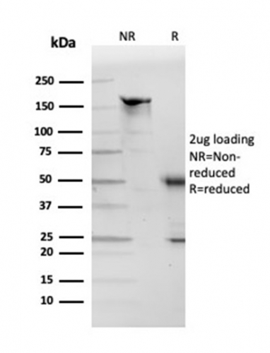 SDS-PAGE Analysis of Purified Apolipoprotein D Mouse Monoclonal Antibody (APOD/3412). Confirmation of Purity and Integrity of Antibody.
