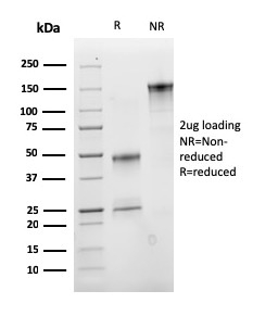 SDS-PAGE Analysis of Purified IGF-1 Mouse Monoclonal Antibody (M23). Confirmation of Purity and Integrity of Antibody.