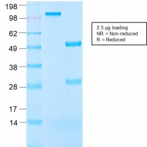 SDS-PAGE Analysis of Purified IGF-1 Rabbit Recombinant Monoclonal Anitbody (IGF1/2872R). Confirmation of Purity and Integrity of Antibody.
