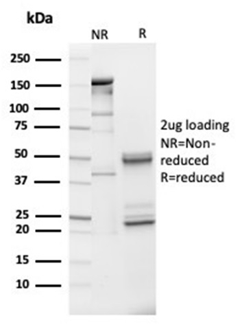 SDS-PAGE Analysis Purified IGFBP3 Mouse Monoclonal Antibody (IGFBP3/3517). Confirmation of Purity and Integrity of Antibody.